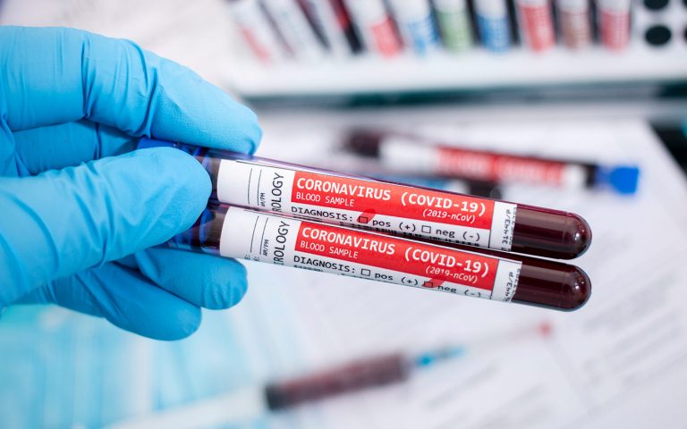 panczel_karoly_radiointerju_van_pozitiv_dh-n_freepik_20200419