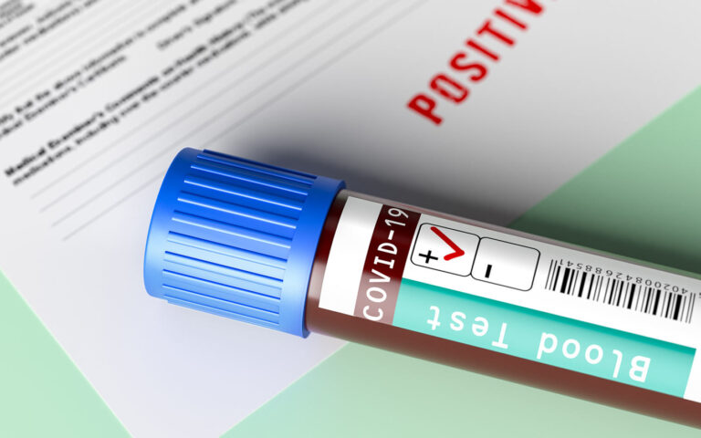 dh-covid-pizitiv_freepik_20200915